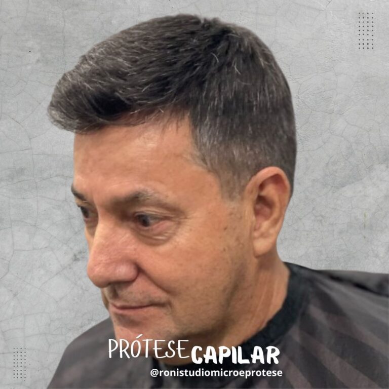 Prótese Capilar Itaperuna